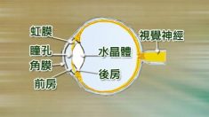 緑内障―気を下げて予防する？