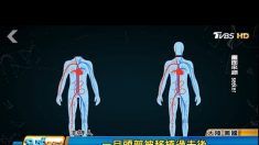 イタリア人医師と中国が人体頭部移植に初成功で非難殺到