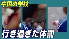 行き過ぎた体罰 生徒の手首を切りつける