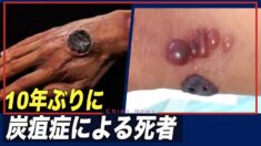 中国 10年ぶりに炭疽症による死者