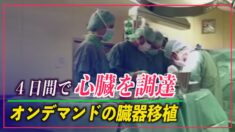 大学教師のために４日間で臓器を調達 オンデマンドの臓器移植