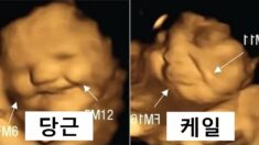 뱃속 아기에게 당근·케일 먹였을 때 초음파에 나타난 표정 차이