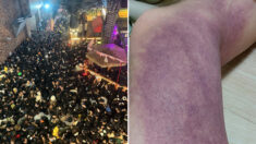 “당시 압박감 이정도” 이태원 생존자가 공개한 사진