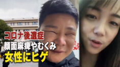 中国のコロナ後遺症 顔面麻痺やむくみ 女性にヒゲ